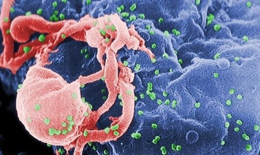 Ученые из соедененных штатов разрабатывают прививки от ВИЧ
