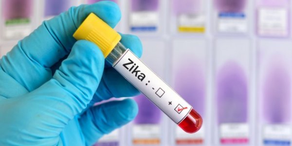 ВОЗ: случаи передачи вируса Зика зафиксированы в 67 государствах