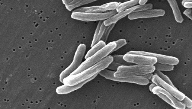 В первый раз за 100 лет: Ученые синтезировали биокапли, способные уничтожить туберкулезную палочку