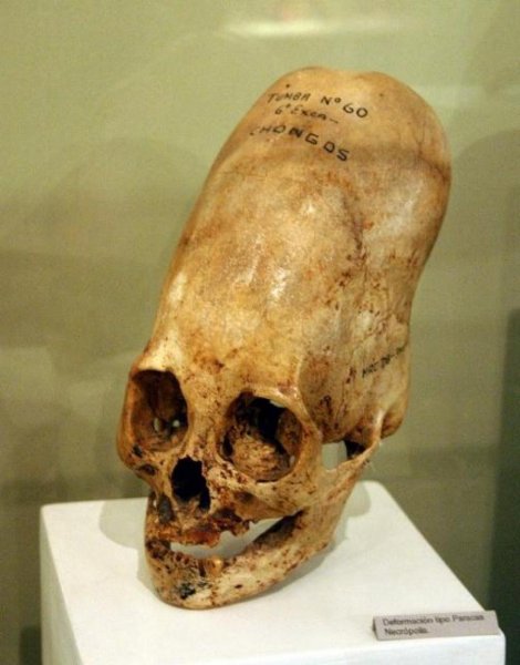 С помощью найденного в «Аркаиме» черепа ученые Уфы воссоздадут вид жрицы