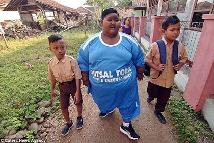 Самый толстый в мире ребенок сбросил вес к академическому году