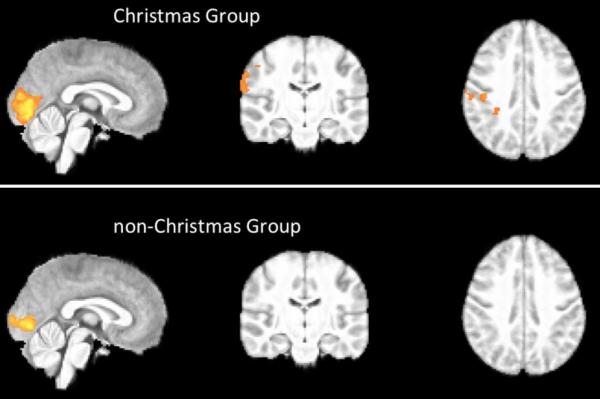 В человеческом мозге существует «Дух Рождества» — Ученые