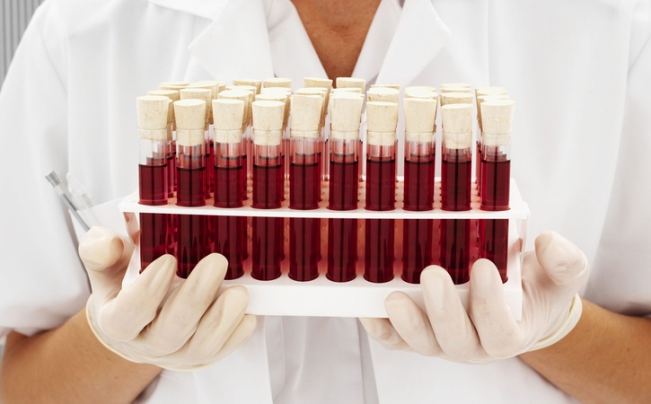 Ученые назвали самую страшную группу крови‍