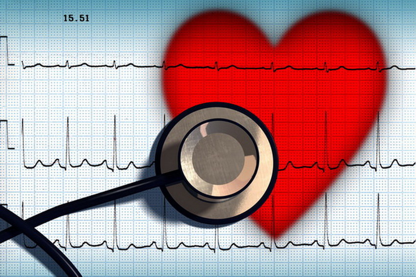 Профессионалы узнали, что увеличивает развитие сердечно-сосудистых заболеваний в 4 раза