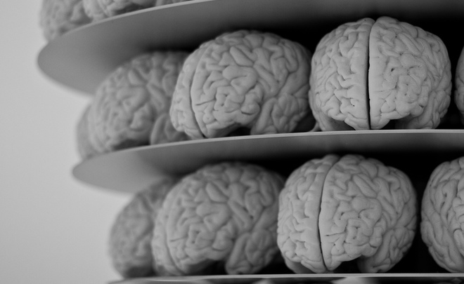 Бельгия получила от Великобритании коллекцию в 3 тыс образцов мозга человека