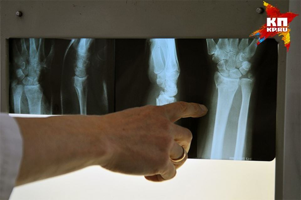 Красноярские ученые разработали способ 3D-печати костей