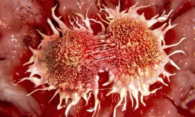 Ученые в первый раз проследили за «рождением» рака кожи