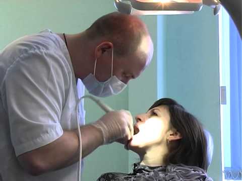 Вредна ли чистка зубов от камня