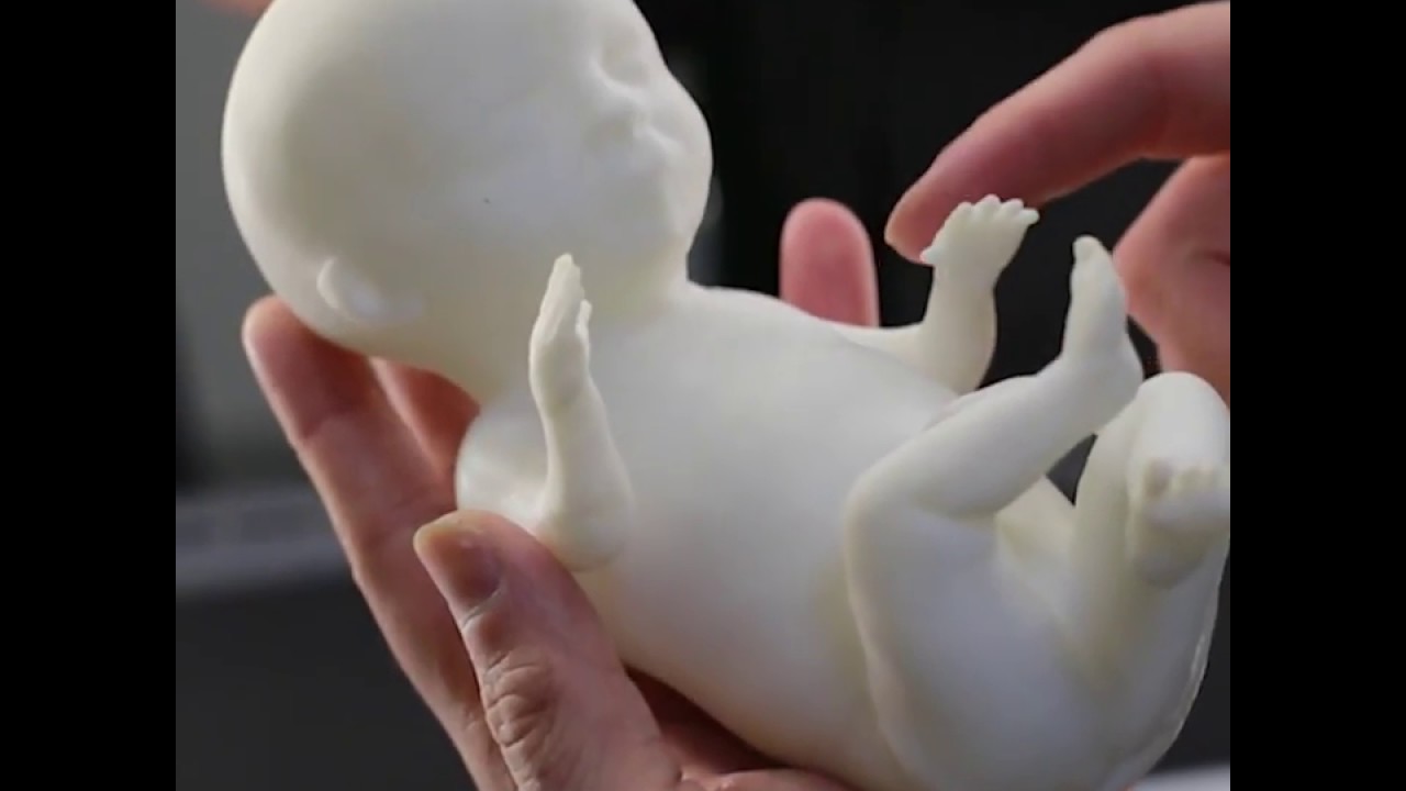 В Уфе изготавливают 3D-модели эмбрионов
