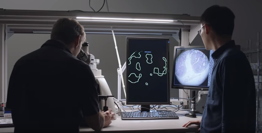 Google разработала микроскоп для выявления раковых клеток