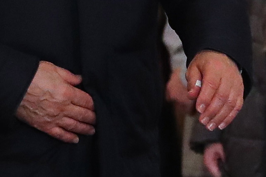 В.Путина увидели с забинтованным пальцем: в Кремле пояснили причину